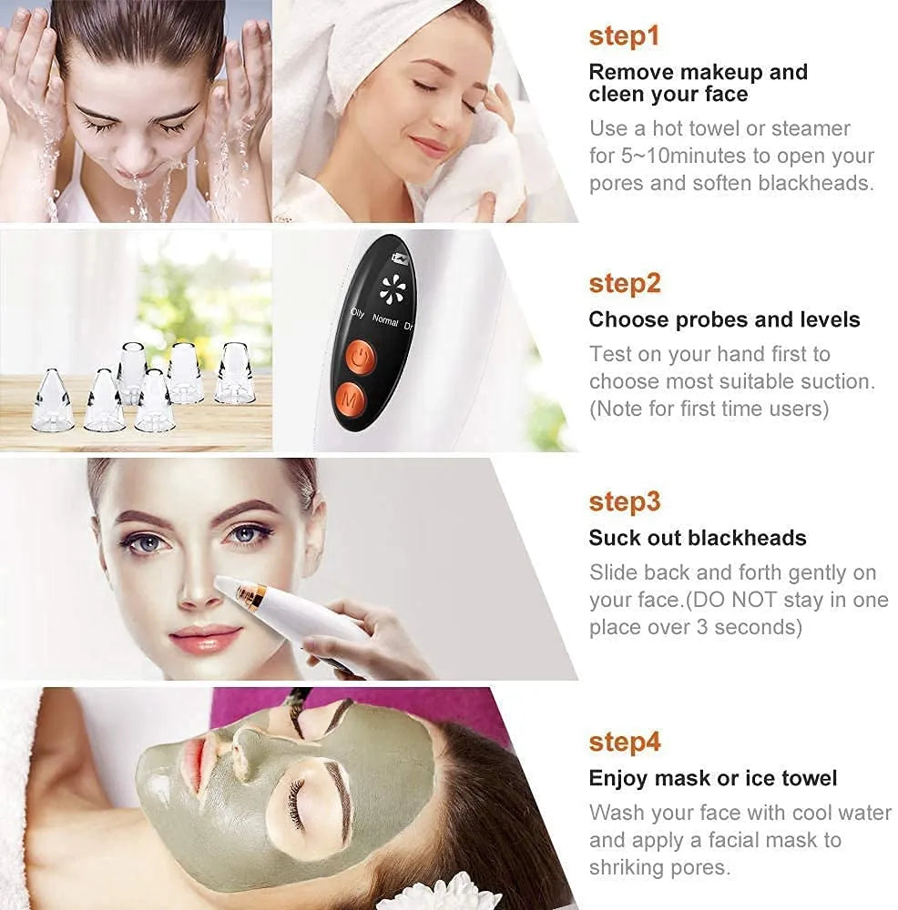 5 in 1 Electric Blackhead Remover Machine